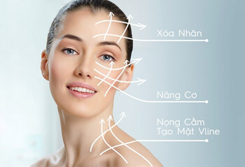 Công nghệ Diaro RF – Nâng cơ, tạo Mặt Vline